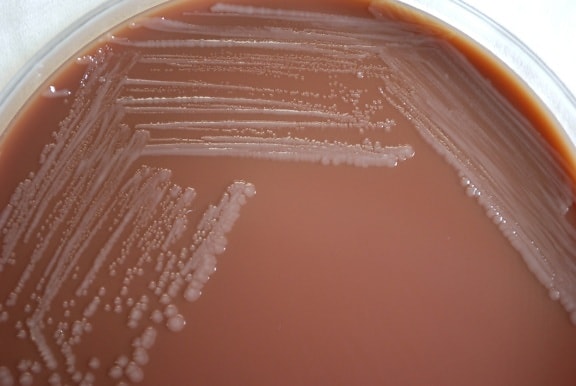 gram negativ, yersinia pestis, bacterii, crescut, rown, ciocolata, agar