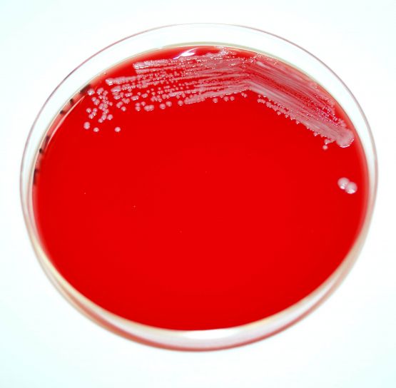 грам, отрицателни, yersinia pestis, бактерии, pestis