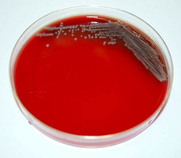 กรัม ลบ yersinia pestis โคโลเนียล เติบโต กกไข่ องศา องศาเซลเซียส