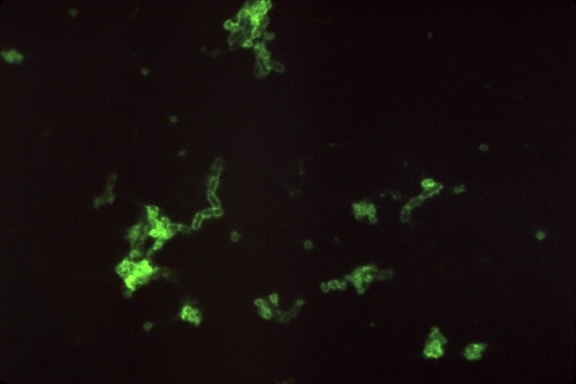 显微图像, 耶尔森菌, 鼠疫, 细菌, 直接, 荧光, 抗体, 染色, 放大