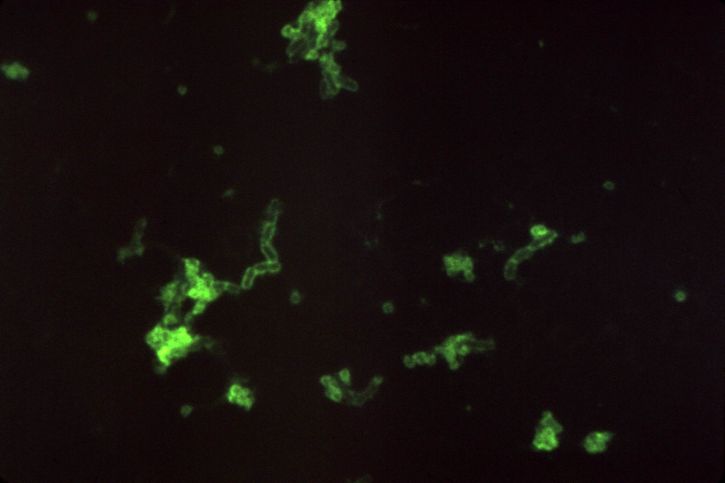 Micrografia, yersinia pestis, bactérias, direta, fluorescentes, anticorpo, mancha, ampliada