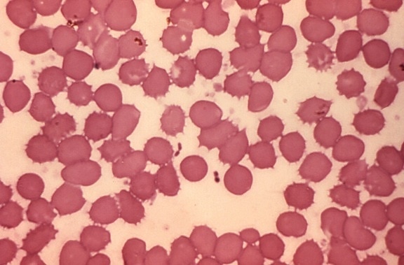 micrografía, muestra de sangre, Yersinia pestis, bacterias, la peste,
