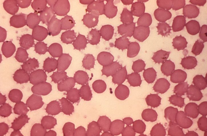 μικρογραφία, κηλίδα αίματος, yersinia pestis, πανούκλα, βακτήρια