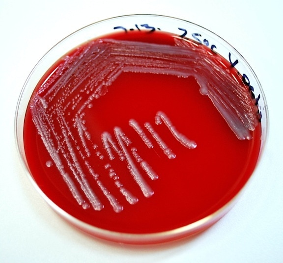 Petri, plato, agar sangre, inoculados, Yersinia pestis, bacterias,
