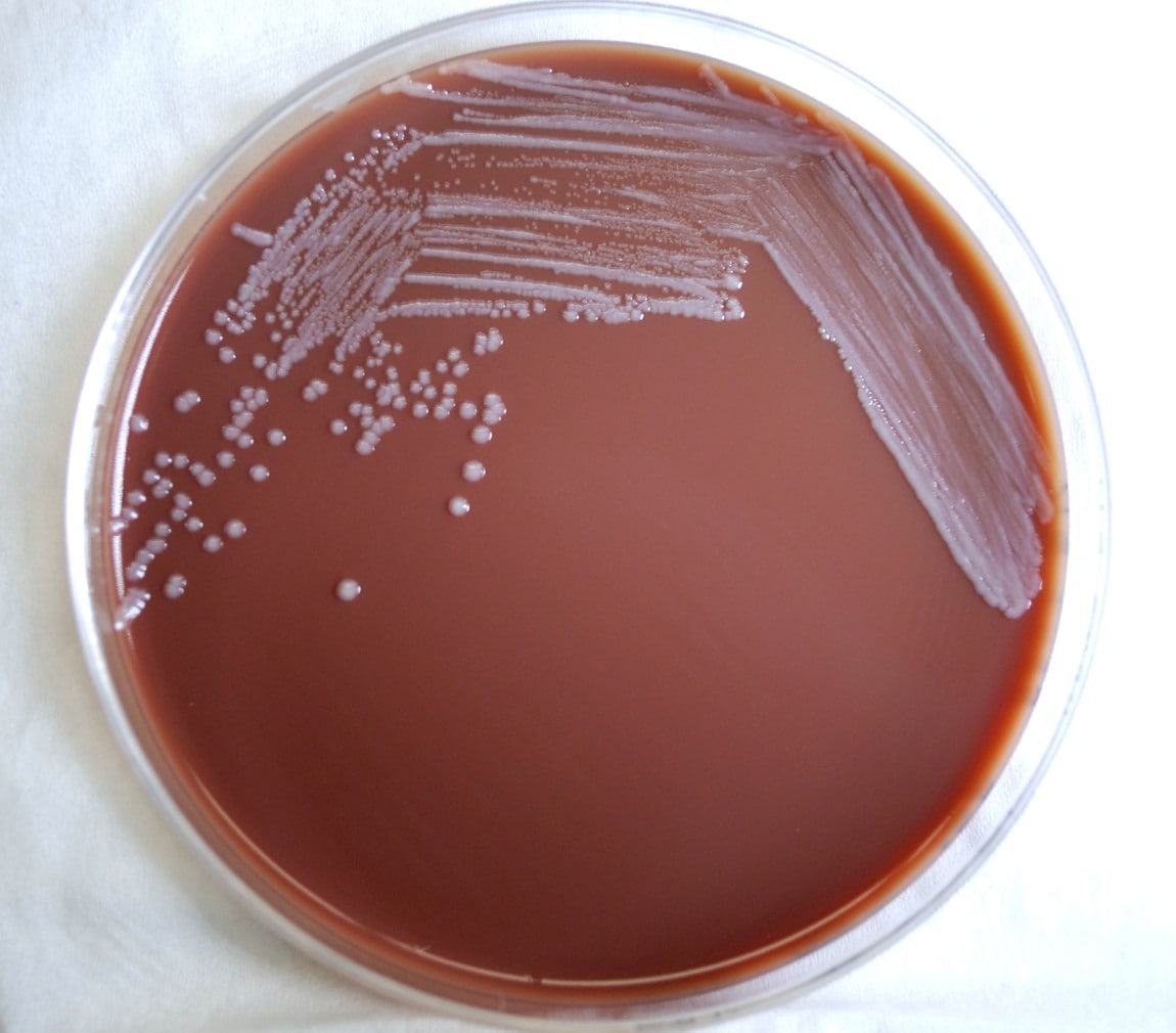 Free picture: gram, negative, yersinia pestis, bacteria, temperature ...