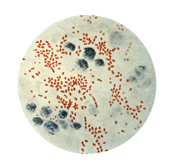 photomicrograph, yersinia, pasteurella pestis, undertiden, bacillus, pestis