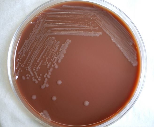 peste, bacterias, Yersinia pestis
