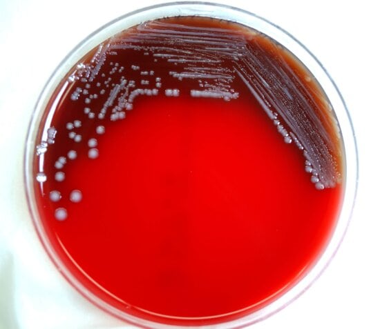 Free picture: yersinia pestis, bacteria, bacteria, temperature, degrees ...