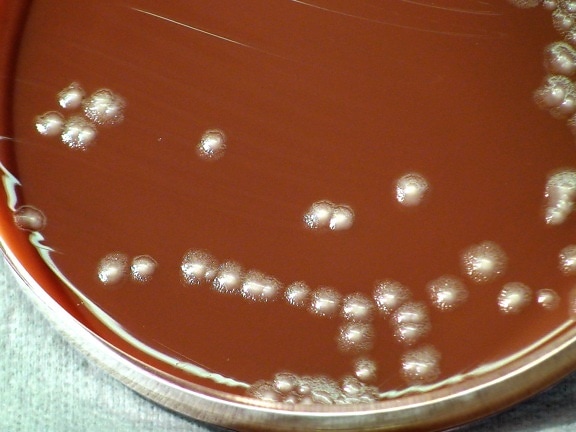 Pestis kolonier, vokser, Petriskål, laboratorium