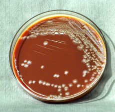 Free Picture: Yersinia Pestis, Bacteria, Grown, Petri, Dish, Blood Agar