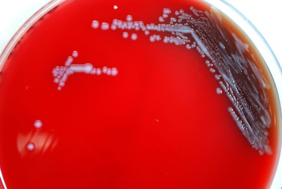 Free picture: yersinia pestis, bacteria, bacteria, temperature, degrees ...