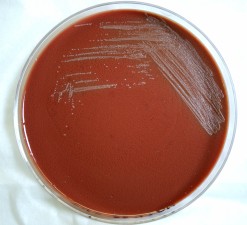 Free picture: gram, negative, yersinia, pestis, bacteria, grown ...