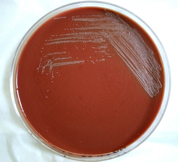 yersinia pestis, bacteria, bacteria, plague
