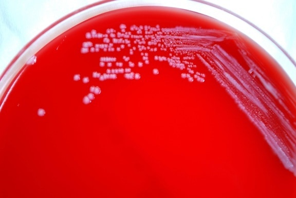 Yersinia pestis, бактерии, отглеждани, Петри, ястие, кръвен агар