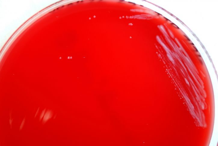 yersinia pestis, bacteria, grown, blood agar