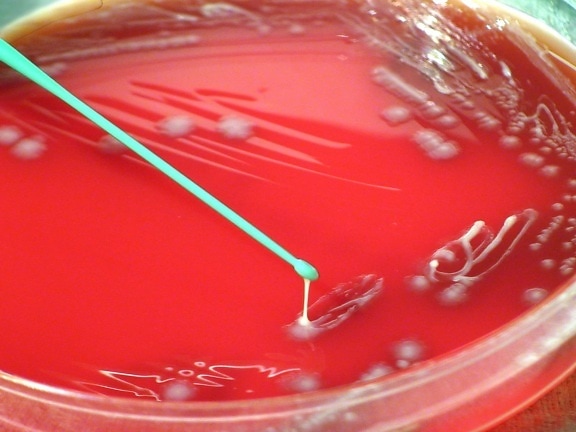 yersinia pestis, bacteria, grown, blood agar, period