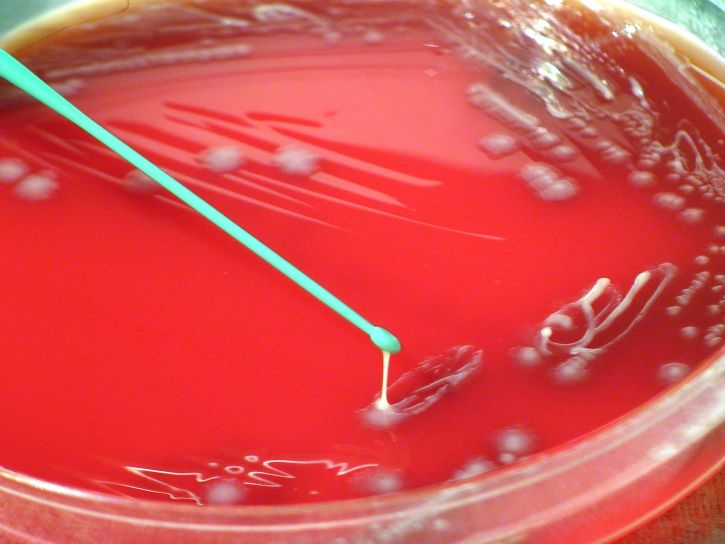 Yersinia pestis, βακτήρια, καλλιεργούνται, άγαρ με αίμα, περίοδος