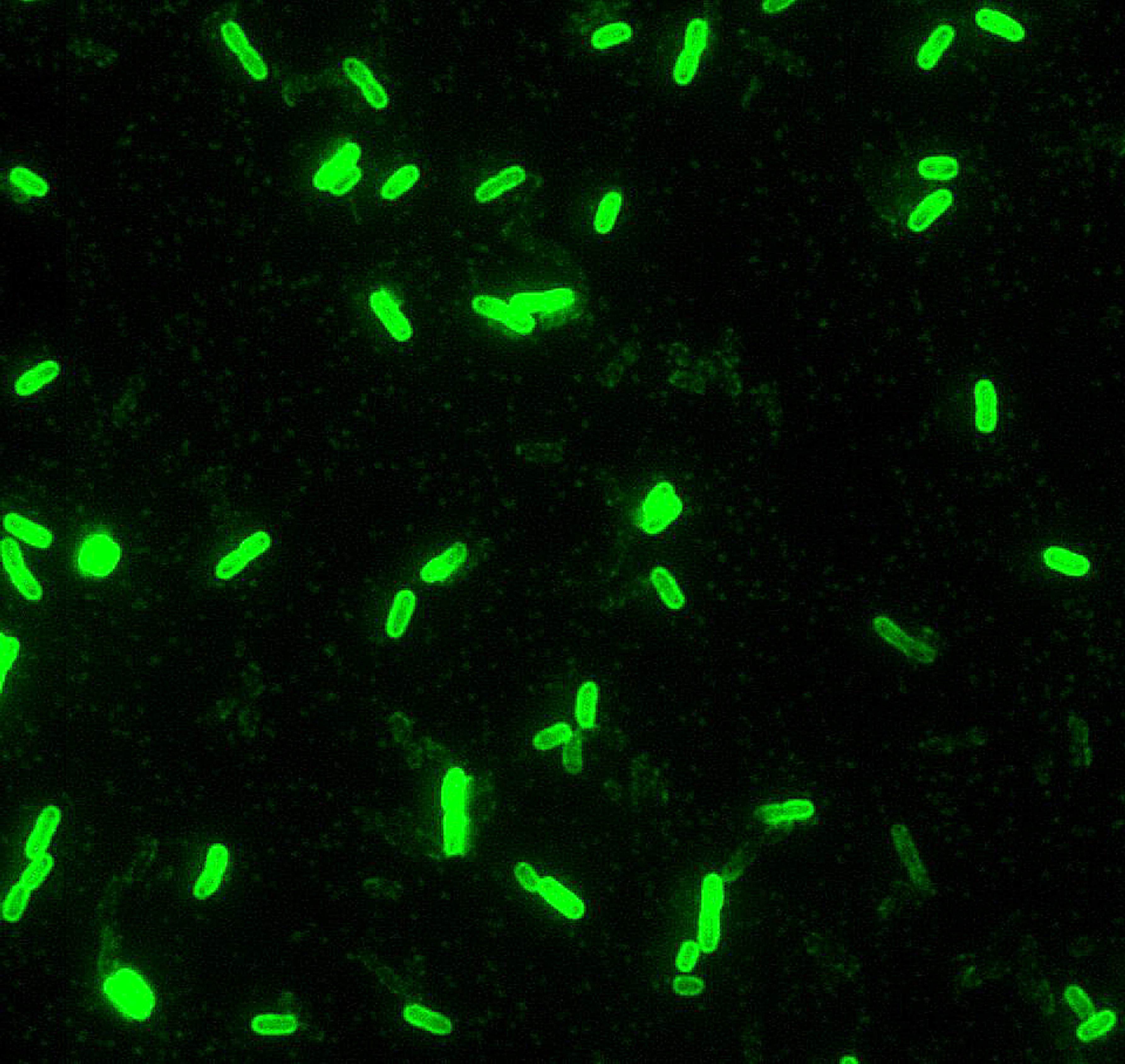 Называют обладают флюоресцируют. Микобактерии туберкулеза люминесцентная микроскопия.