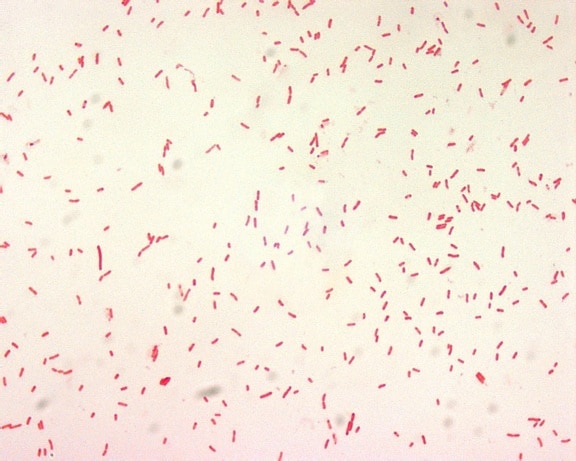 yersinia pestis, gram, negative, bacillus