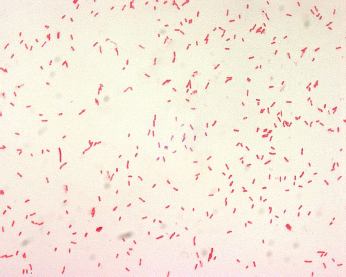 yersinia pestis, gram, negative, bacillus