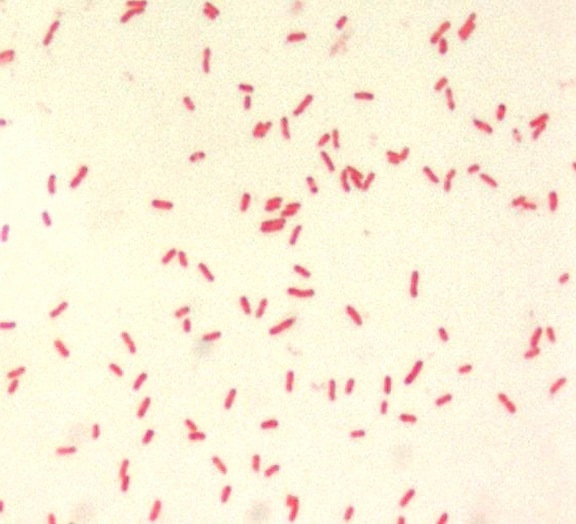 yersinia pestis, small, gram, negative, bacillus