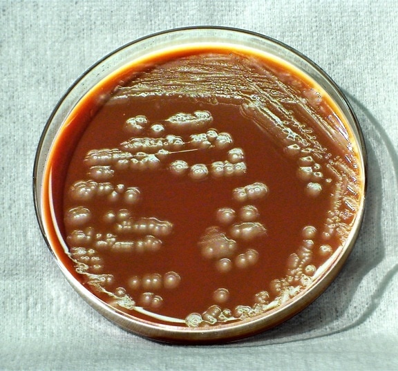 yersinia เชื้อแบคทีเรียก่อโรค pestis