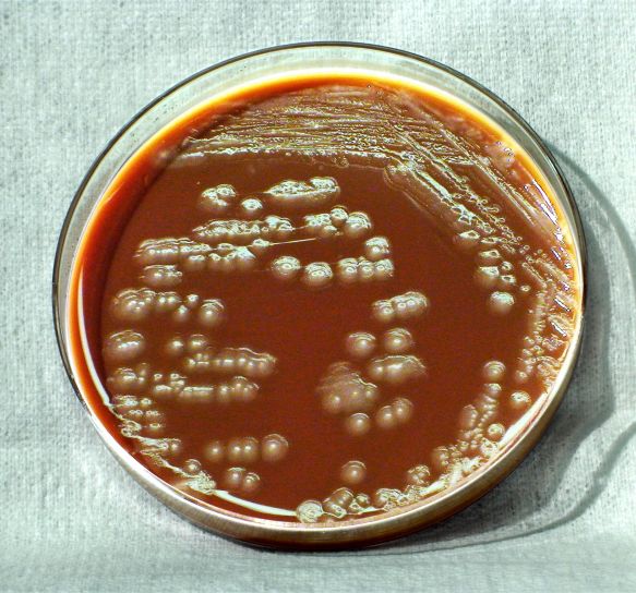 Yersinia pestis, bacterii patogene,