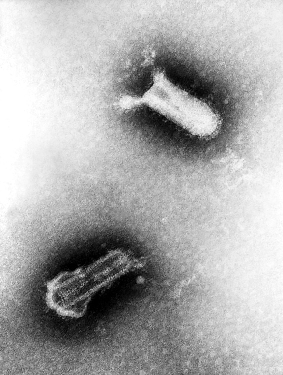ปรากฏตัว สอง piry ไวรัส virions หมายเหตุ สัญลักษณ์ รูปร่าง ขนาดเล็ก 155nm, 162nm, virions