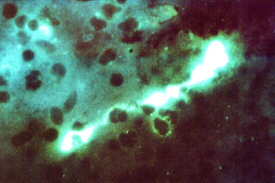bacteria, chlamydophila psittaci
