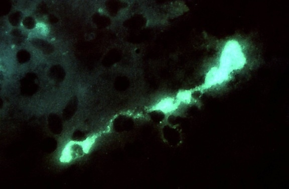 Chlamydia psittaci, bakterier, mus, hjärnan, vävnad, mag, 400 x