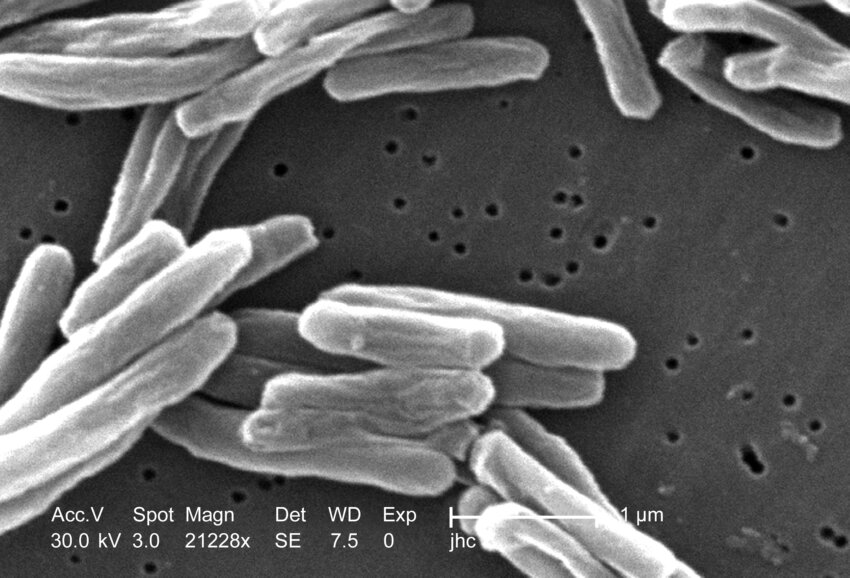 Kostenlose Bild: obligat, Aerobic, Organismus, Tuberkulose, überleben ...