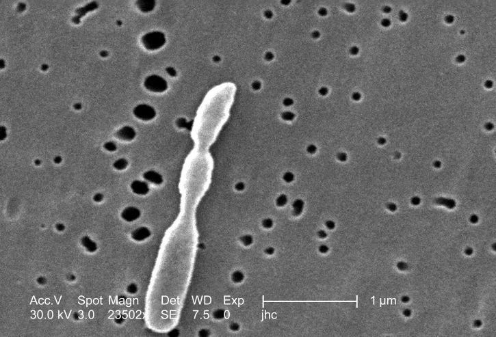 baktériumok, a folyamat alatt, befejeződött a replikáció ad okot, három, külön, bacteri