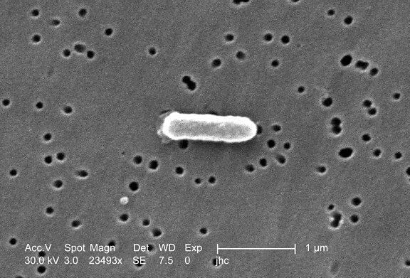 enlarged, ralstonia mannitolilytica bacterium