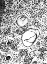 Free picture: spumavirus, virions