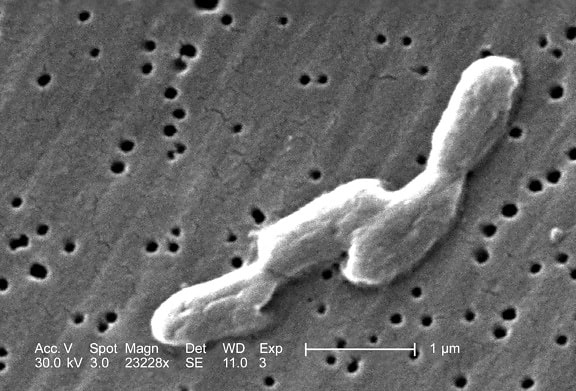 almonella infantis, дійсно, один, сальмонели, патогенних мікроорганізмів