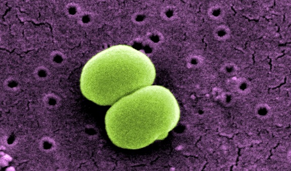 scanning, electron micrograph, two, staphylococcus epidermidis, bacteria