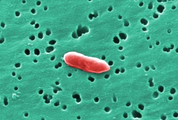 กรัม termitidis, sebaldella เป็นลบ แบคทีเรีย