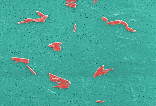 micrograph, numbers, gram, negative, sebaldella termitidis, bacteria