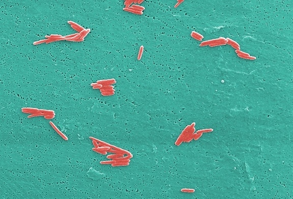 mikroskop-bilde, antall, gram, negativ, sebaldella termitidis, bakterier
