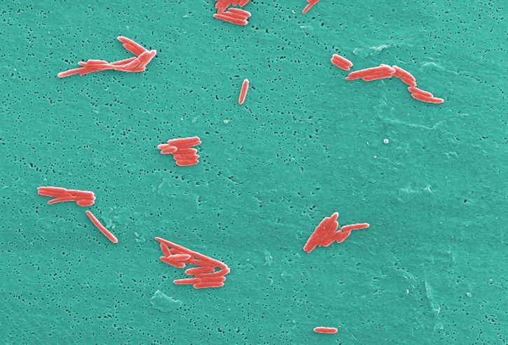 mikroskop-bilde, antall, gram, negativ, sebaldella termitidis, bakterier