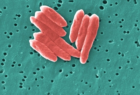 ขนาดเล็ก จัดกลุ่ม กรัม ลบ sebaldella termitidis แบคทีเรีย