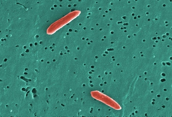 กรัม termitidis, sebaldella เป็นลบ แบคทีเรีย