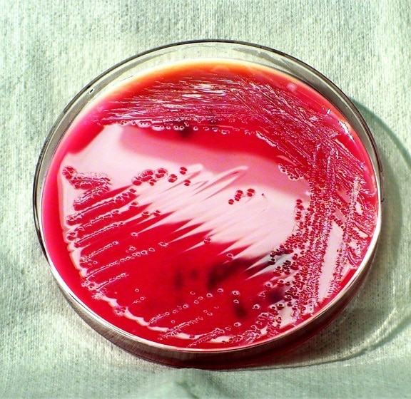 gram, negative, shigella boydii, bacteria