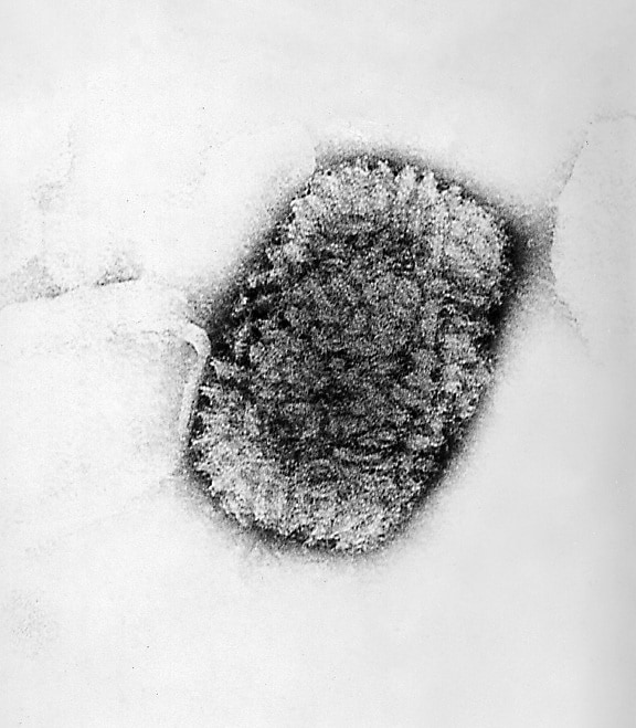 electron micrograph, vaccinia, virus, close