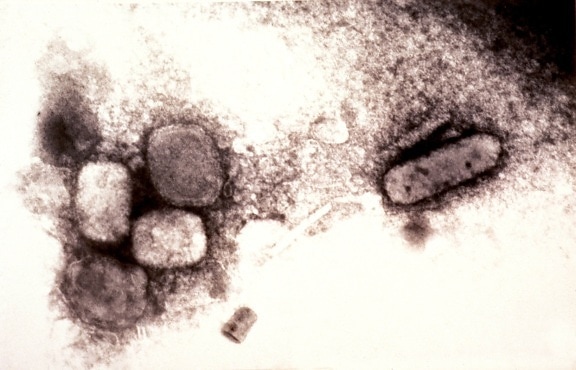 micrograph, variola, smallpox, virus, negative, stain, technique, magnification, 65000x