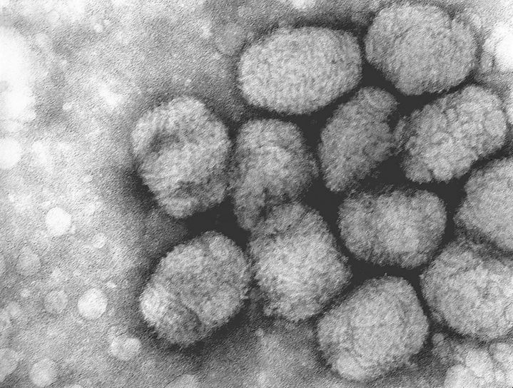 伝送、電子顕微鏡写真、天然痘ウイルス