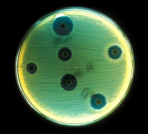 แอโรบิก แบคทีเรีย staphylococcus หมอเทศข้าง ลาย ล้าง ยา แผ่น วุ้น ทดสอบ ความไวแสง