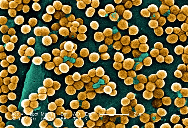 อิเล็กตรอน micrograp มากมาย กระจุก methicillin ทน staphylococcus หมอเทศข้างลาย แบคทีเรีย