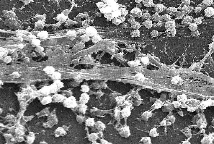 elektron mikroskop-bilde, store, tall, staphylococcus aureus, bakterier