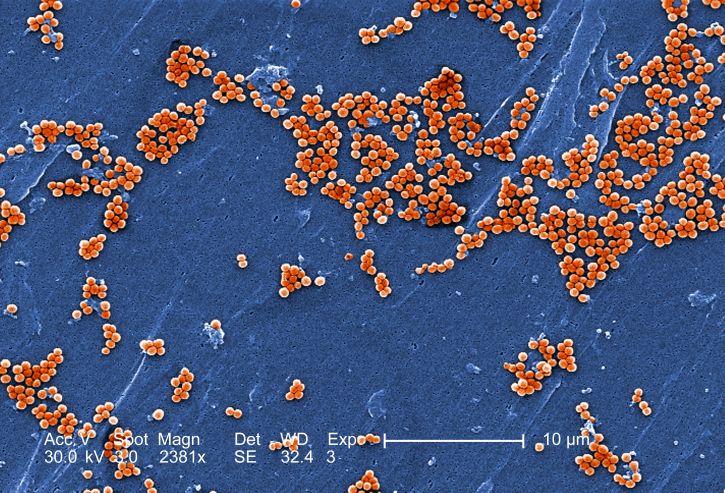 electron micrograph, numerous, clumps, methicillin, resistant, staphylococcus aureus, bacteria